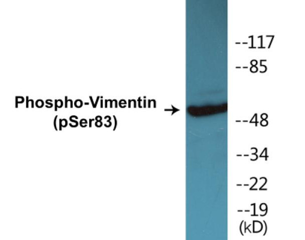 Vimentin (Phospho-Ser83)Colorimetric Cell-Based ELISA Kit (CBCAB01487)
