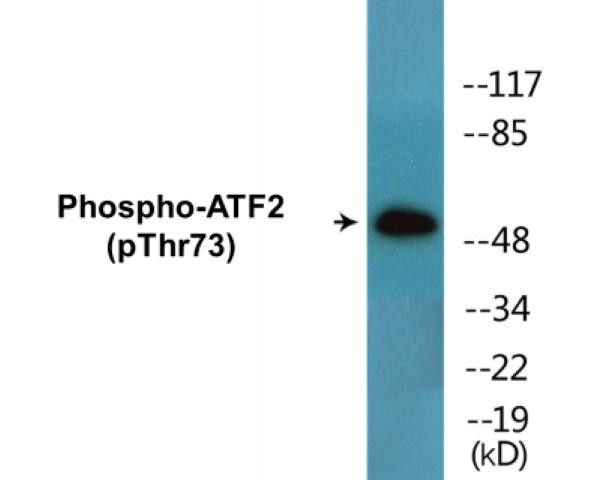 ATF2 (Phospho-Thr73)Colorimetric Cell-Based ELISA Kit (CBCAB01495)