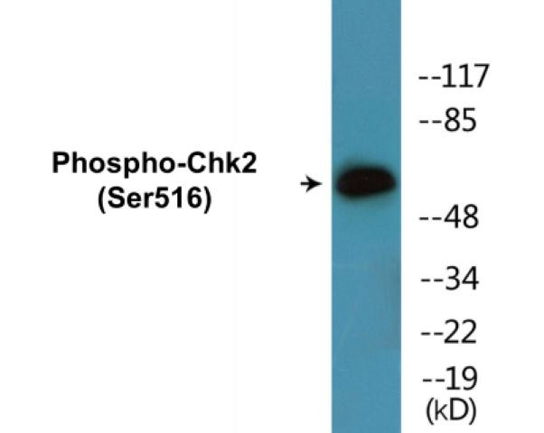 Chk2 (Phospho-Ser516)Colorimetric Cell-Based ELISA Kit (CBCAB01508)