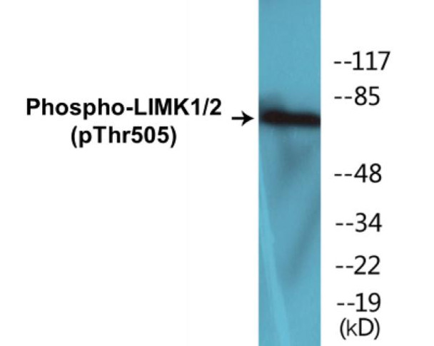 LIMK1/2 (Phospho-Thr505)Colorimetric Cell-Based ELISA Kit (CBCAB01561)