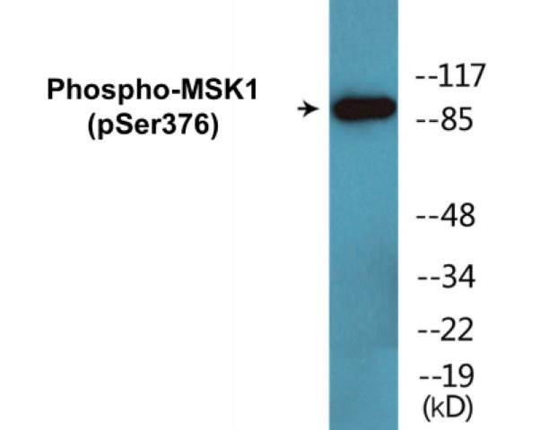 MSK1 (Phospho-Ser376)Colorimetric Cell-Based ELISA Kit (CBCAB01571)