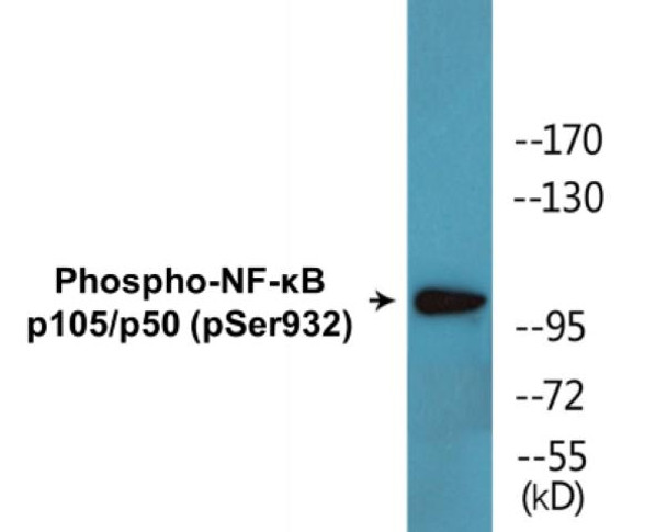 NF-kappaB p105/p50 (Phospho-Ser932)Colorimetric Cell-Based ELISA Kit (CBCAB01573)