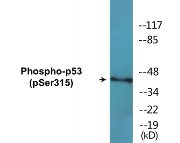 p53 (Phospho-Ser315)Colorimetric Cell-Based ELISA Kit (CBCAB01587)