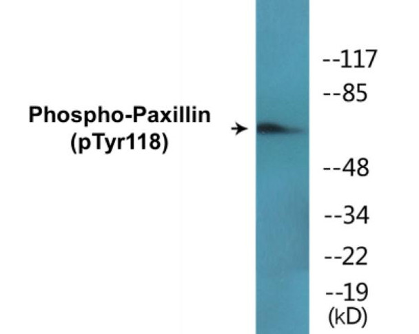 Paxillin (Phospho-Tyr118)Colorimetric Cell-Based ELISA Kit (CBCAB01594)