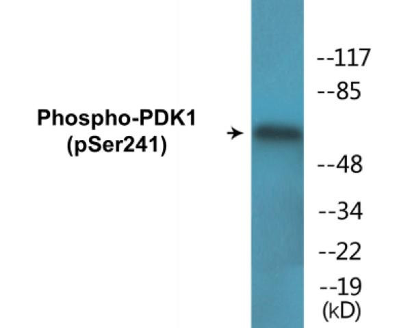 PDK1 (Phospho-Ser241)Colorimetric Cell-Based ELISA Kit (CBCAB01596)