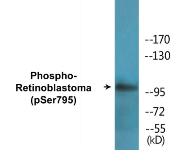 Retinoblastoma (Phospho-Ser795)Colorimetric Cell-Based ELISA Kit (CBCAB01603)