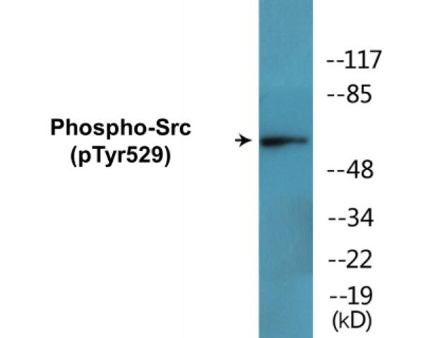 Src (Phospho-Tyr529)Colorimetric Cell-Based ELISA Kit (CBCAB01608)