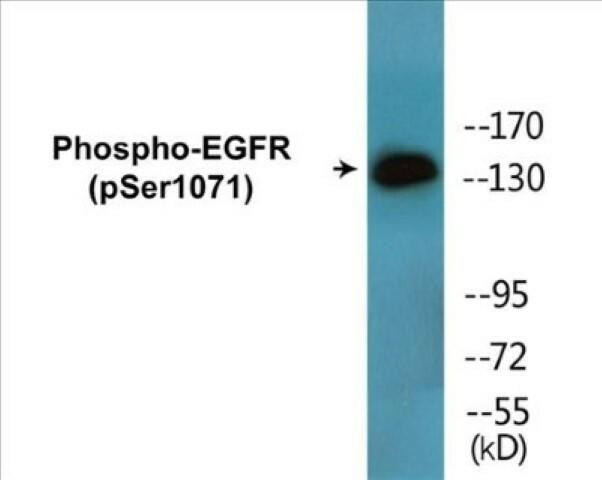 EGFR (Phospho-Ser1071)Colorimetric Cell-Based ELISA Kit (CBCAB01626)