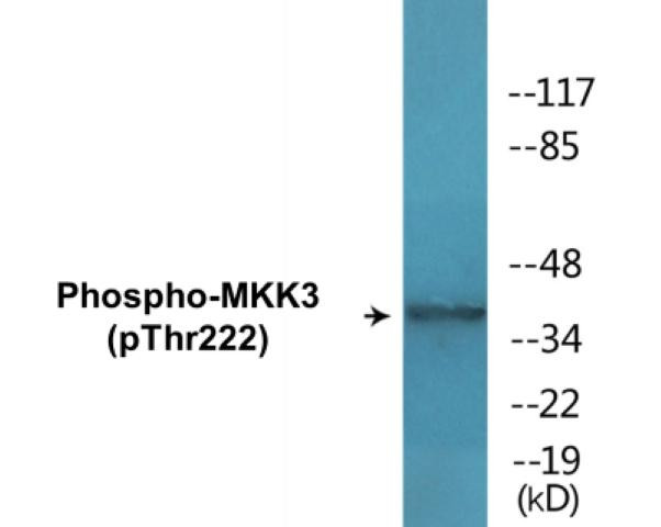 MKK3 (Phospho-Thr222)Colorimetric Cell-Based ELISA Kit (CBCAB01648)
