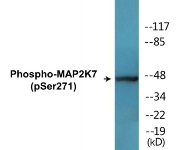 MAP2K7 (Phospho-Ser271)Colorimetric Cell-Based ELISA Kit (CBCAB01649)