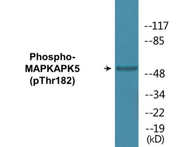 MAPKAPK5 (Phospho-Thr182)Colorimetric Cell-Based ELISA Kit (CBCAB01681)
