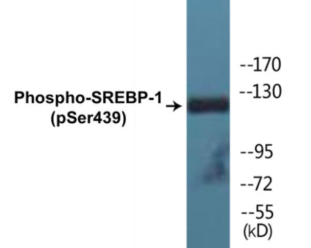 SREBP-1 (Phospho-Ser439)Colorimetric Cell-Based ELISA Kit (CBCAB01690)