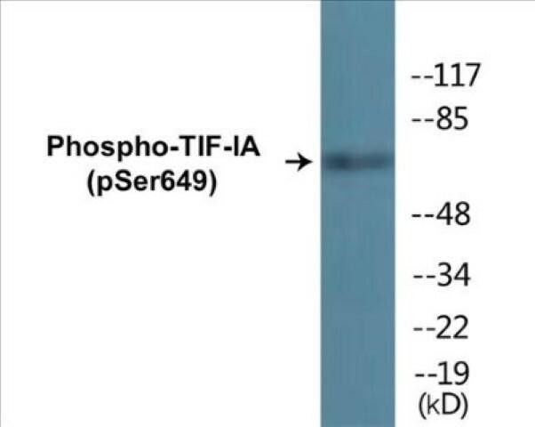 TIF-IA (Phospho-Ser649)Colorimetric Cell-Based ELISA Kit (CBCAB01691)