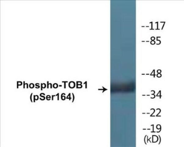 TOB1 (Phospho-Ser164)Colorimetric Cell-Based ELISA Kit (CBCAB01692)