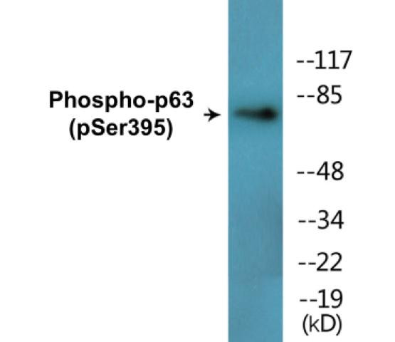 p63 (Phospho-Ser395)Colorimetric Cell-Based ELISA Kit (CBCAB01696)