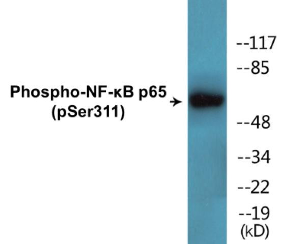 NF-kB p65 (Phospho-Ser311)Fluorometric Cell-Based ELISA Kit (FBCAB00073)