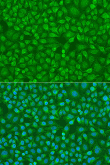 IRF7 Rabbit Polyclonal Antibody (CAB0159)