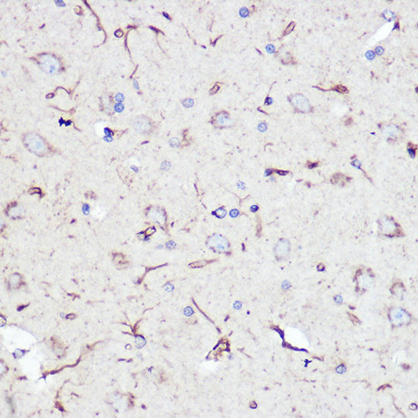 GFAP Rabbit Polyclonal Antibody (CAB0237)