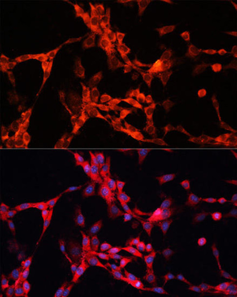 GSK3α Rabbit Polyclonal Antibody (CAB0645)