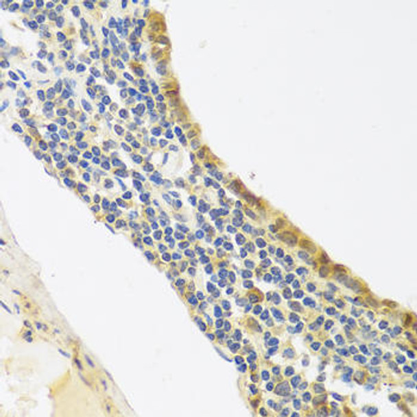 Endothelin 1 Rabbit Polyclonal Antibody (CAB0686)