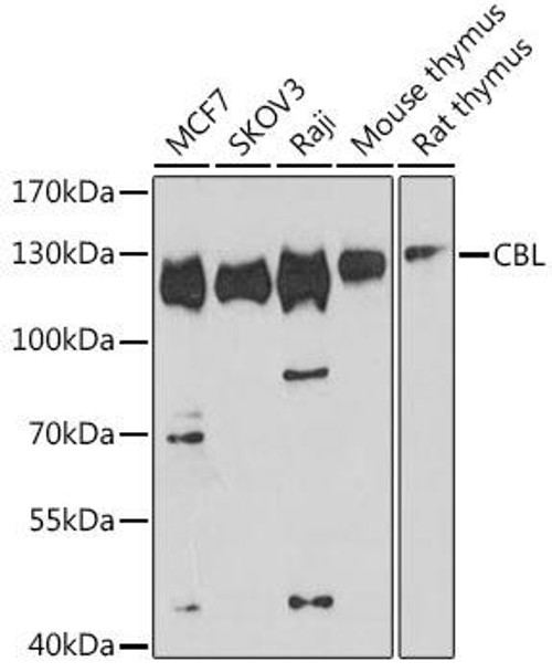 CBL Rabbit Polyclonal Antibody (CAB0732)