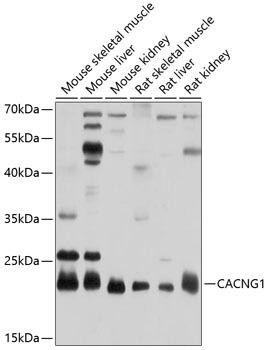 CACNG1 Rabbit Polyclonal Antibody (CAB10014)