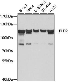 PLD2 Rabbit Polyclonal Antibody (CAB10192)