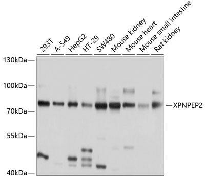 XPNPEP2 Rabbit Polyclonal Antibody (CAB10255)