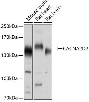 CACNA2D2 Rabbit Polyclonal Antibody (CAB10267)