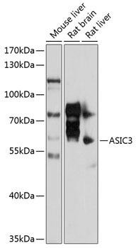 ASIC3 Rabbit Polyclonal Antibody (CAB10268)