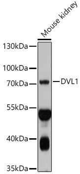 DVL1 Rabbit Polyclonal Antibody (CAB10536)