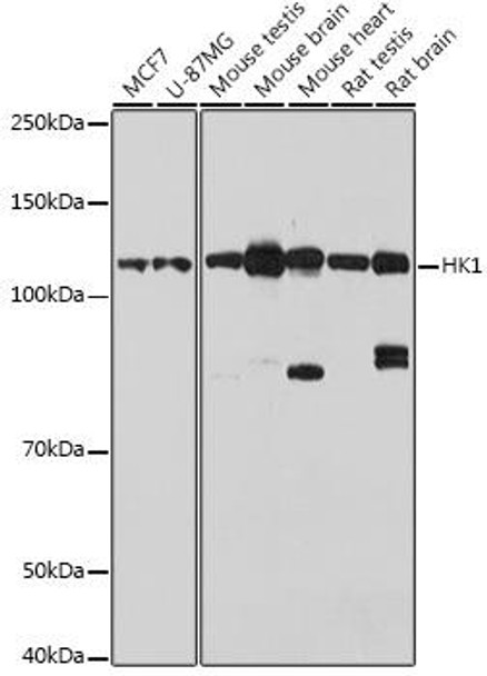 [KO Validated] HK1 Rabbit Polyclonal Antibody (CAB1054)