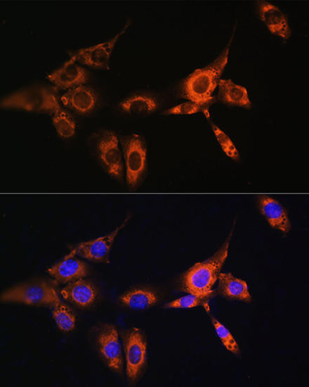 ARRB2 Rabbit Polyclonal Antibody (CAB1171)