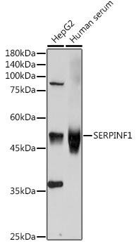 PEDF/SERPINF1 Rabbit Polyclonal Antibody (CAB11782)