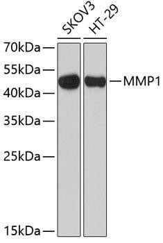 MMP1 Rabbit Polyclonal Antibody (CAB1191)