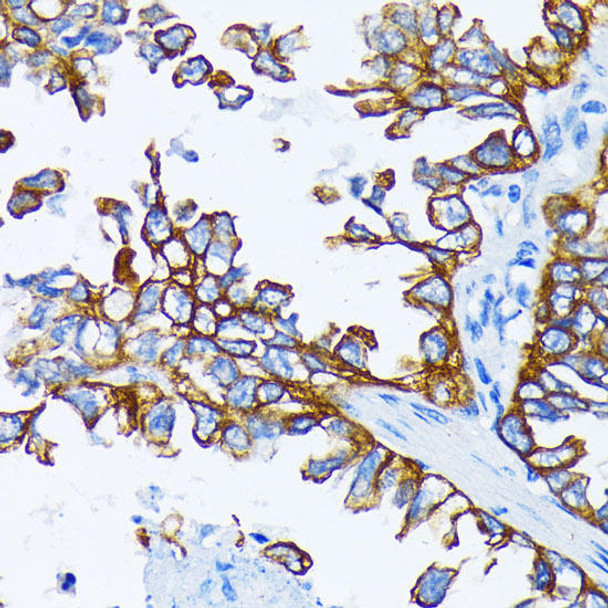 Cytokeratin 7 (KRT7) Rabbit Polyclonal Antibody (CAB12004)