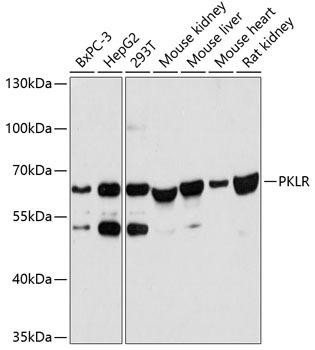 PKLR Rabbit Polyclonal Antibody (CAB12084)