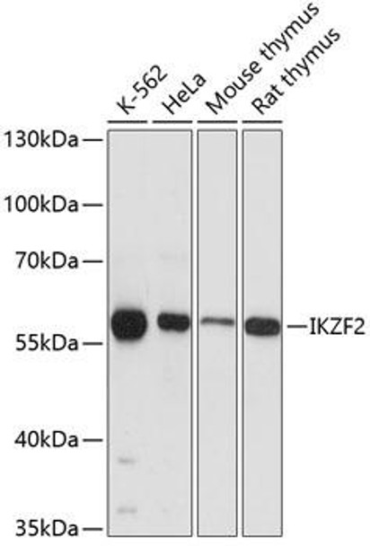 IKZF2 Rabbit Polyclonal Antibody (CAB12265)