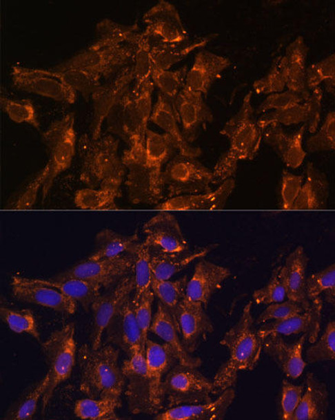 HSD17B8 Rabbit Polyclonal Antibody (CAB12947)
