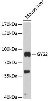 GYS2 Rabbit Polyclonal Antibody (CAB13020)