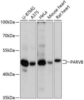 PARVB Rabbit Polyclonal Antibody (CAB13161)