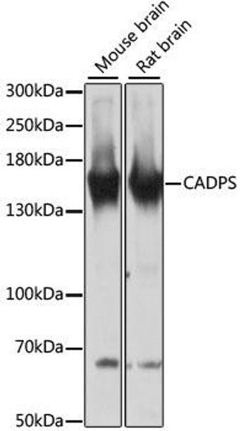 CADPS Rabbit Polyclonal Antibody (CAB13186)