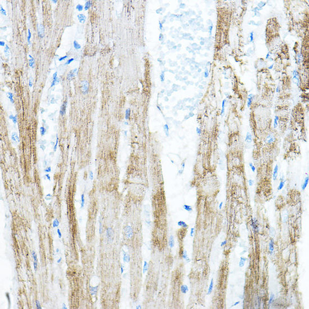 PDK4 Rabbit Polyclonal Antibody (CAB13337)