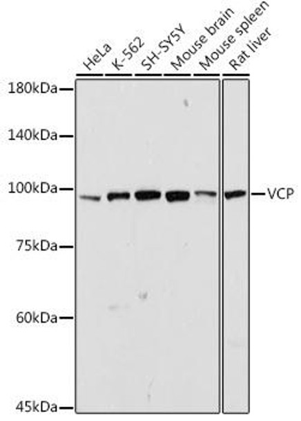 VCP Rabbit Polyclonal Antibody (CAB13368)