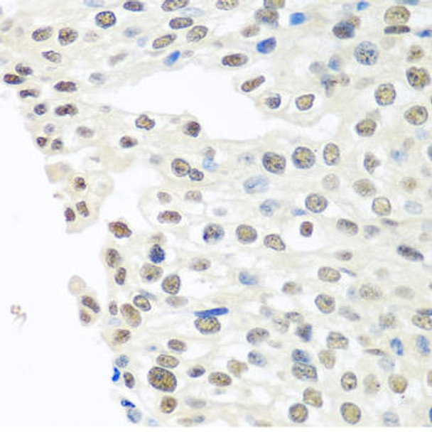 TDP-43/TARDB Rabbit Polyclonal Antibody (CAB13405)