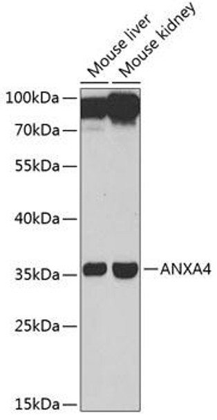 Annexin A4/Annexin IV Rabbit Polyclonal Antibody (CAB13466)