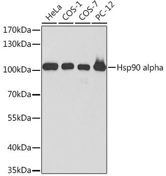 Hsp90α Rabbit Polyclonal Antibody (CAB13501)