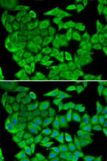 MDH2 Rabbit Polyclonal Antibody (CAB13516)