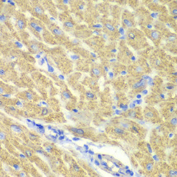 GLRX3 Rabbit Polyclonal Antibody (CAB13580)