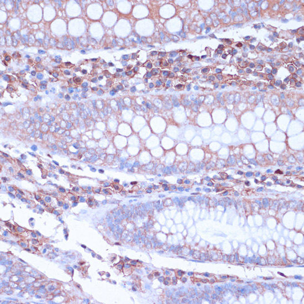 CD38 Rabbit Polyclonal Antibody (CAB13611)